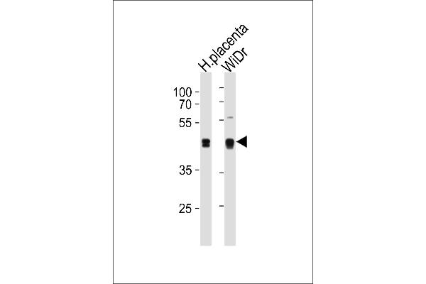 SAP30BP 抗体  (AA 160-188)