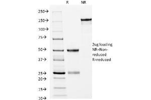 Image no. 1 for anti-Major Histocompatibility Complex, Class II, DR beta 1 (HLA-DRB1) antibody (ABIN6939645)