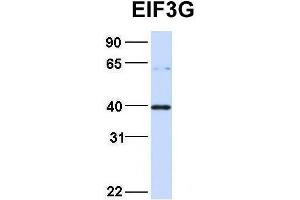 Image no. 4 for anti-Eukaryotic Translation Initiation Factor 3, Subunit G (EIF3G) (Middle Region) antibody (ABIN2778865)