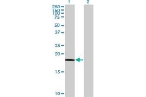 Image no. 1 for anti-Retinoic Acid Receptor Responder (Tazarotene Induced) 3 (RARRES3) (AA 1-164) antibody (ABIN519657)
