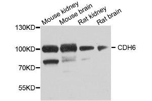 Image no. 3 for anti-K-Cadherin (CDH6) antibody (ABIN6138299)