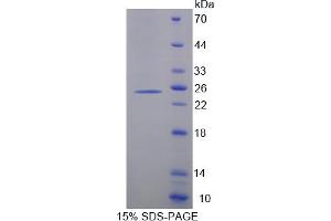 Image no. 1 for Cytochrome P450, Family 26, Subfamily A, Polypeptide 1 (CYP26A1) (AA 73-255) protein (His tag) (ABIN6236995)