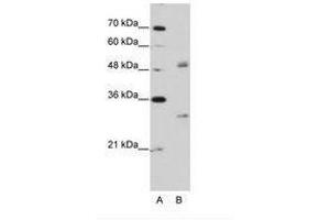 Image no. 2 for anti-Eukaryotic Translation Initiation Factor 4H (EIF4H) (AA 149-198) antibody (ABIN203036)