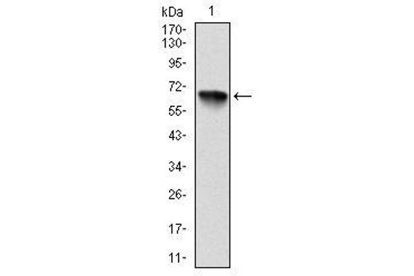 anti-Ribosomal Protein S6 Kinase, 90kDa, Polypeptide 3 (RPS6KA3) antibody