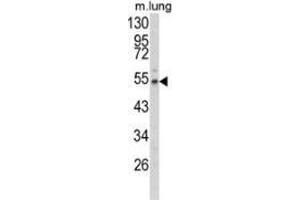 Image no. 2 for anti-Fibulin 3 (FBLN3) (AA 126-156), (N-Term) antibody (ABIN952326)