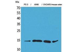 anti-Chemokine (C-C Motif) Ligand 26 (CCL26) (Internal Region) antibody