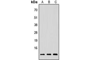 Image no. 1 for anti-Neuregulin 4 (NRG4) (Center) antibody (ABIN2706712)