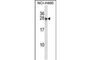 Image no. 1 for anti-Molybdenum Cofactor Synthesis 2 (MOCS2) (AA 14-43), (N-Term) antibody (ABIN5533418)
