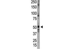 Image no. 1 for anti-Bone Morphogenetic Protein 5 (BMP5) (AA 16-46) antibody (ABIN3030178)