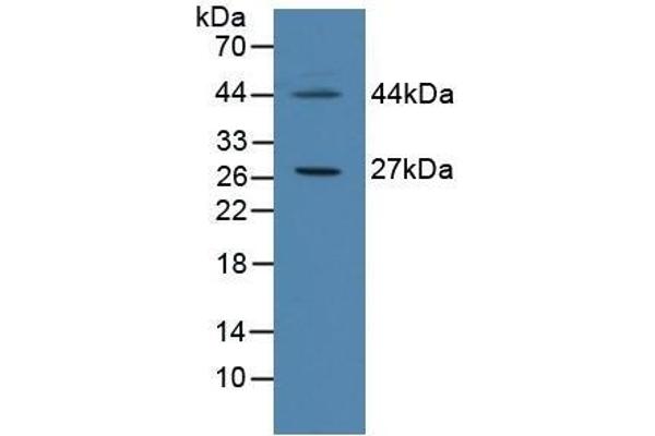 CIDEC 抗体  (AA 1-251)