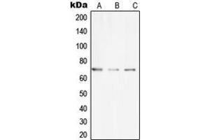 Image no. 1 for anti-CAP-GLY Domain Containing Linker Protein Family, Member 4 (CLIP4) (Center) antibody (ABIN2705897)