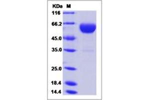 Image no. 1 for Carboxypeptidase B2 (Plasma) (CPB2) (AA 1-422) protein (His tag) (ABIN2693277)