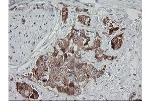 Image no. 2 for anti-Mitochondrial Ribosomal Protein S34 (MRPS34) antibody (ABIN1499564)