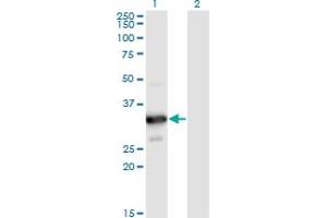 Image no. 1 for anti-Myozenin 2 (MYOZ2) (AA 1-264) antibody (ABIN949355)