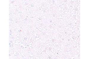 Image no. 1 for anti-Mesenchyme Homeobox 1 (MEOX1) antibody (ABIN5583430)
