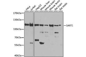 Image no. 1 for anti-Squamous Cell Carcinoma Antigen Recognized By T Cells (SART1) antibody (ABIN6571846)