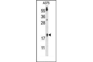 Image no. 3 for anti-Family with Sequence Similarity 96, Member B (FAM96B) (C-Term), (N-Term) antibody (ABIN952260)