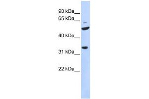 Image no. 2 for anti-Zinc Finger Protein 36, C3H Type-Like 2 (ZFP36L2) (N-Term) antibody (ABIN2777902)