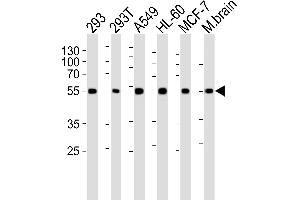 Image no. 3 for anti-DKK3 (AA 15-45), (N-Term) antibody (ABIN5532899)