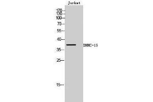 Image no. 1 for anti-Zinc Finger, DHHC-Type Containing 15 (ZDHHC15) (C-Term) antibody (ABIN3184301)