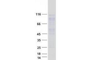 Image no. 1 for rho/rac Guanine Nucleotide Exchange Factor (GEF) 2 (ARHGEF2) protein (Myc-DYKDDDDK Tag) (ABIN2714892)