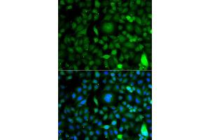 Image no. 1 for anti-D4, Zinc and Double PHD Fingers Family 1 (DPF1) antibody (ABIN4903505)
