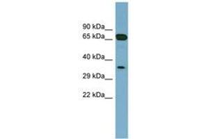 Image no. 1 for anti-Glyoxalase Domain Containing 4 (GLOD4) (AA 143-192) antibody (ABIN6741898)