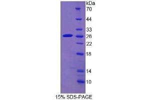 Image no. 1 for Cytochrome P450, Family 2, Subfamily D, Polypeptide 6 (CYP2D6) (AA 236-472) protein (His tag) (ABIN1099018)
