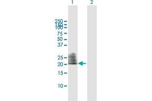 Image no. 2 for anti-CD160 (CD160) (AA 1-181) antibody (ABIN524537)