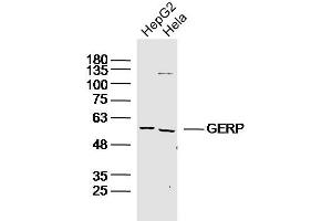 Image no. 1 for anti-Tripartite Motif Containing 8 (TRIM8) antibody (ABIN1387072)
