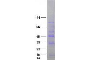 Image no. 1 for serine/threonine Kinase 19 (STK19) (Transcript Variant 1) protein (Myc-DYKDDDDK Tag) (ABIN2732864)