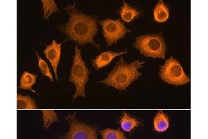 Immunofluorescence analysis of L929 cells using RIG-I / DDX58 Polyclonal Antibody at dilution of 1:100.