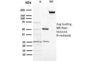 Image no. 1 for anti-Proopiomelanocortin (POMC) (N-Term) antibody (ABIN6940336)