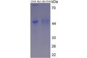 Image no. 2 for Amyloid beta 40 (Abeta 40) peptide (Ovalbumin) (ABIN5666069)