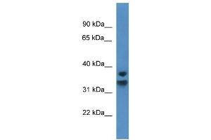 Image no. 1 for anti-Nuclear Factor of kappa Light Polypeptide Gene Enhancer in B-Cells Inhibitor, delta (NFKBID) (C-Term) antibody (ABIN926561)