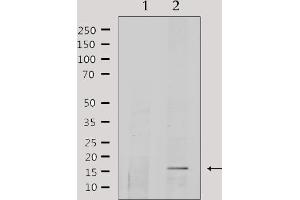 Image no. 3 for anti-Cytochrome C Oxidase Subunit Va (COX5A) antibody (ABIN6258416)