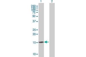 Image no. 1 for anti-Secretoglobin, Family 2A, Member 2 (SCGB2A2) (AA 1-93) antibody (ABIN517902)