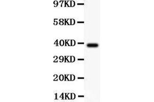 Image no. 4 for anti-V-Crk Sarcoma Virus CT10 Oncogene Homolog (Avian) (CRK) (AA 2-246) antibody (ABIN3042758)