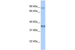 Image no. 1 for anti-Zinc Finger Protein 64 (ZFP64) (Middle Region) antibody (ABIN2777779)