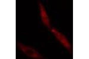 Image no. 2 for anti-CCR4-NOT Transcription Complex Subunit 4 (CNOT4) (N-Term) antibody (ABIN6257069)