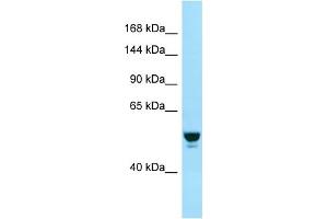 Image no. 1 for anti-RAB GTPase Activating Protein 1 (RABGAP1) (N-Term) antibody (ABIN2774440)