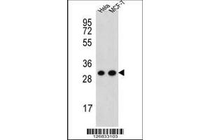 Image no. 1 for anti-Cytochrome C1 (CYC1) (AA 259-287), (C-Term) antibody (ABIN651531)