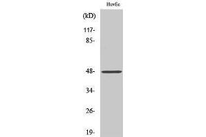 Image no. 1 for anti-Cathepsin E (CTSE) (Internal Region) antibody (ABIN3183693)