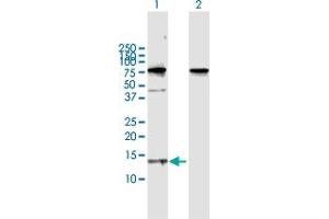 Image no. 2 for anti-Chemokine (C-C Motif) Ligand 21 (CCL21) (AA 1-134) antibody (ABIN520068)