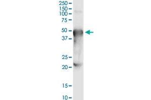 Image no. 2 for anti-Porcupine Homolog (PORCN) (AA 1-450) antibody (ABIN1327267)