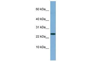 Image no. 1 for anti-Neuroblastoma 1, DAN Family BMP Antagonist (NBL1) (Middle Region) antibody (ABIN633987)