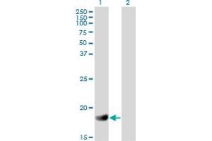 Image no. 3 for anti-Regulator of G-Protein Signaling 3 (RGS3) (AA 1-192) antibody (ABIN562645)
