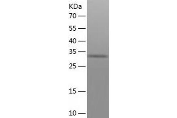Thrombospondin 1 Protein (THBS1) (AA 19-350) (His tag)