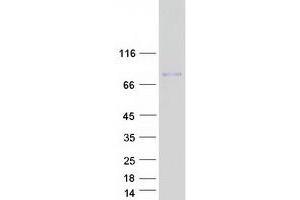 Image no. 1 for Gliomedin (GLDN) protein (Myc-DYKDDDDK Tag) (ABIN2721937)