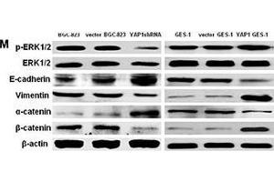 Image no. 27 for anti-Actin, beta (ACTB) (AA 1-50) antibody (ABIN724340)